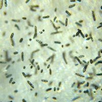 what is spirulina - microscope observation of Live Spirulina Algae Seed Culture